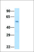 Anti-PAX7 antibody produced in rabbit affinity isolated antibody