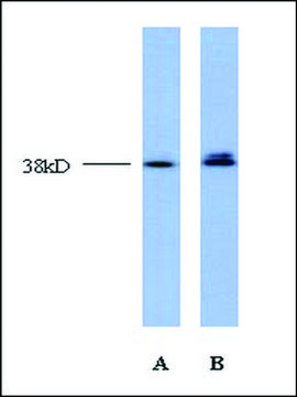 Anti-TCF4 (AB2) antibody produced in rabbit affinity isolated antibody