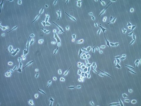 MB49 Mouse Bladder Carcinoma Cell Line MB49 mouse urothelial carcinoma cell line is widely used as an in vitro and in vivo model of bladder cancer.