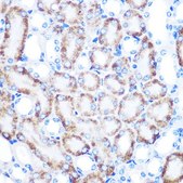 Anti- CD168/RHAMM antibody produced in rabbit
