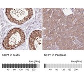 Anti-STIP1 antibody produced in rabbit Prestige Antibodies® Powered by Atlas Antibodies, affinity isolated antibody, buffered aqueous glycerol solution