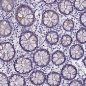 Anti-TACSTD2 antibody produced in rabbit Prestige Antibodies® Powered by Atlas Antibodies, affinity isolated antibody, buffered aqueous glycerol solution