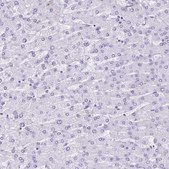 Anti-PROCR antibody produced in rabbit Prestige Antibodies® Powered by Atlas Antibodies, affinity isolated antibody, buffered aqueous glycerol solution