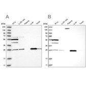 Anti-PNPO antibody produced in rabbit Prestige Antibodies® Powered by Atlas Antibodies, affinity isolated antibody, buffered aqueous glycerol solution