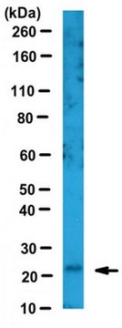 Anti-Thymidylate Kinase/TMPK Antibody from rabbit