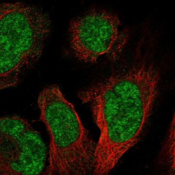 Anti-Pbxip1 Antibody Produced In Rabbit Prestige Antibodies&#174; Powered by Atlas Antibodies, affinity isolated antibody, buffered aqueous glycerol solution