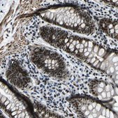 Anti-PRCC antibody produced in rabbit Prestige Antibodies® Powered by Atlas Antibodies, affinity isolated antibody, buffered aqueous glycerol solution, Ab1