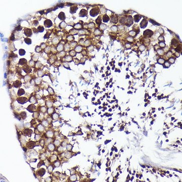 Anti-PRMT5 antibody produced in rabbit