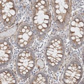 Anti-CAAP1 antibody produced in rabbit Prestige Antibodies® Powered by Atlas Antibodies, affinity isolated antibody, buffered aqueous glycerol solution, Ab3