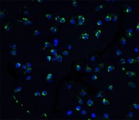 Anti-ZIPK antibody produced in rabbit affinity isolated antibody, buffered aqueous solution