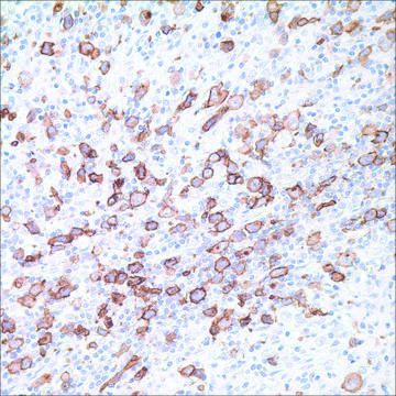 CD30 (Ber-H2) Mouse Monoclonal Antibody