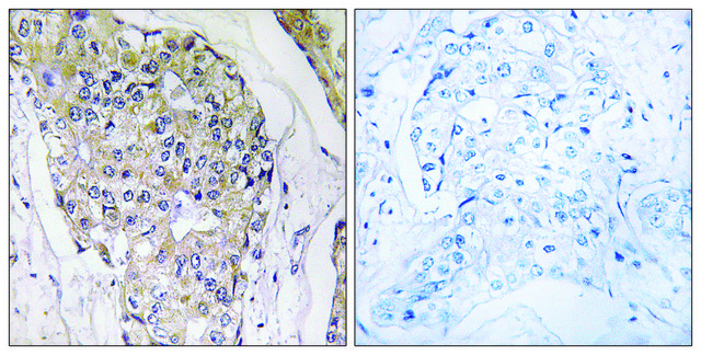 Anti-NDUFS6 antibody produced in rabbit affinity isolated antibody