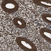 Anti-VCP antibody produced in rabbit Prestige Antibodies® Powered by Atlas Antibodies, affinity isolated antibody, buffered aqueous glycerol solution