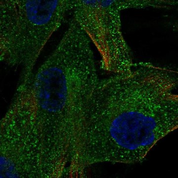 Anti-PDGFRB antibody produced in rabbit Prestige Antibodies&#174; Powered by Atlas Antibodies, affinity isolated antibody, buffered aqueous glycerol solution