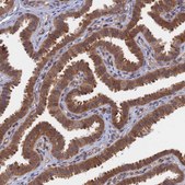 Anti-BLVRA antibody produced in rabbit Prestige Antibodies® Powered by Atlas Antibodies, affinity isolated antibody, buffered aqueous glycerol solution