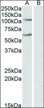 Anti-IREB2 antibody produced in goat affinity isolated antibody, buffered aqueous solution