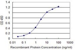 Monoclonal Anti-TIAM2 antibody produced in mouse clone 1C10, purified immunoglobulin, buffered aqueous solution