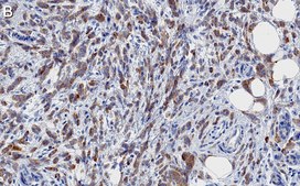 Anti-Phospho-ACC1-(Ser79) Antibody, clone 1E11 ZooMAb® Rabbit Monoclonal recombinant, expressed in HEK 293 cells