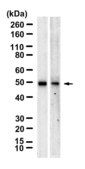 Anti-ARP3 Antibody, clone 1C7 ZooMAb&#174; Rabbit Monoclonal recombinant, expressed in HEK 293 cells