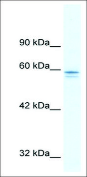 抗-MTF1 兔抗 IgG fraction of antiserum