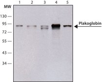 Monoclonal Anti-Plakoglobin (Catenin γ) antibody produced in mouse clone 15F11, ascites fluid, buffered aqueous solution