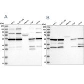 Anti-PDHX antibody produced in rabbit Prestige Antibodies® Powered by Atlas Antibodies, affinity isolated antibody, buffered aqueous glycerol solution