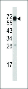 ANTI-CD105 (CENTER E395) antibody produced in rabbit purified immunoglobulin, buffered aqueous solution