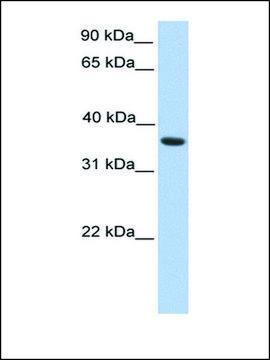 Anti-MAGEA4 antibody produced in rabbit affinity isolated antibody