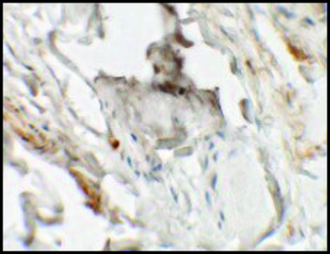 Anti-HHATL antibody produced in rabbit affinity isolated antibody