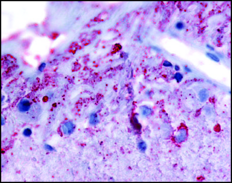 Anti-GRM6 antibody produced in rabbit affinity isolated antibody, buffered aqueous solution