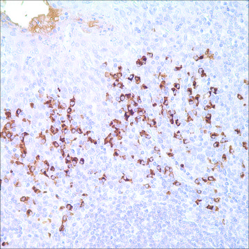 IgD Rabbit Polyclonal Antibody