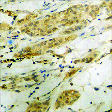 Anti-phospho-Cofilin (pSer3) antibody produced in rabbit affinity isolated antibody