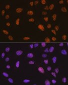 Anti- SMARCB1/SNF5 antibody produced in rabbit