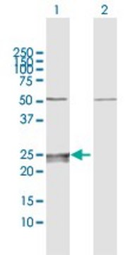 Anti-CMPK1 antibody produced in rabbit purified immunoglobulin, buffered aqueous solution