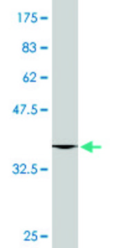 Monoclonal Anti-UROD, (C-terminal) antibody produced in mouse clone 2F5, purified immunoglobulin, buffered aqueous solution