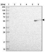 Anti-MIDN antibody produced in rabbit Prestige Antibodies® Powered by Atlas Antibodies, affinity isolated antibody, buffered aqueous glycerol solution