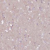 Anti-COL8A1 antibody produced in rabbit Prestige Antibodies® Powered by Atlas Antibodies, affinity isolated antibody, buffered aqueous glycerol solution
