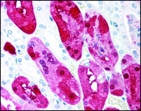 Anti-C1QTNF5 antibody produced in rabbit IgG fraction of antiserum, buffered aqueous solution