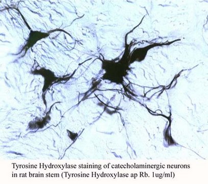 Anti-Tyrosine Hydroxylase Antibody Chemicon&#174;, from rabbit