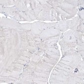 Anti-MMRN1 antibody produced in rabbit Prestige Antibodies® Powered by Atlas Antibodies, affinity isolated antibody, buffered aqueous glycerol solution