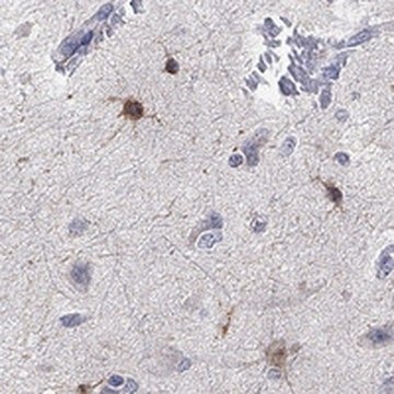 Anti-TMEM169 antibody produced in rabbit Prestige Antibodies&#174; Powered by Atlas Antibodies, affinity isolated antibody, buffered aqueous glycerol solution