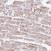 Anti-TIMM13 antibody produced in rabbit Prestige Antibodies® Powered by Atlas Antibodies, affinity isolated antibody, buffered aqueous glycerol solution