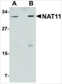 Anti-NAT11 antibody produced in rabbit affinity isolated antibody, buffered aqueous solution