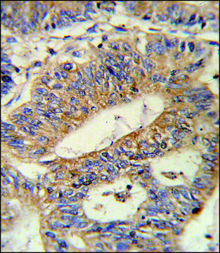 ANTI-IL17RB (CENTER) antibody produced in rabbit IgG fraction of antiserum, buffered aqueous solution