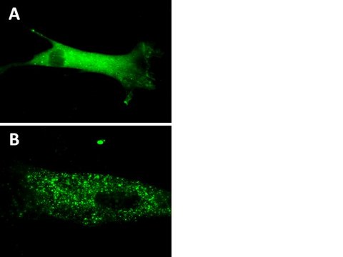 LentiBrite GFP-p62 Lentiviral Biosensor