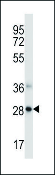 ANTI-NDFIP1 (CENTER) antibody produced in rabbit IgG fraction of antiserum, buffered aqueous solution