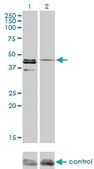 Monoclonal Anti-CSNK1G1 antibody produced in mouse clone 3F10, purified immunoglobulin, buffered aqueous solution