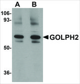 Anti-GOLPH2 antibody produced in rabbit affinity isolated antibody, buffered aqueous solution