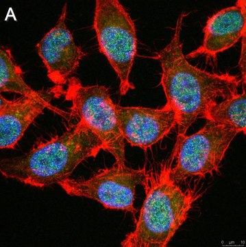 Anti-TCF-4 Antibody, clone 1G4 ZooMAb&#174; Rabbit Monoclonal recombinant, expressed in HEK 293 cells