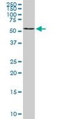 Monoclonal Anti-B4GALNT1 antibody produced in mouse clone 5F9, purified immunoglobulin, buffered aqueous solution